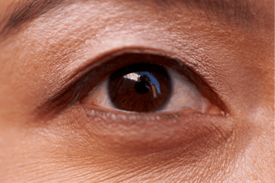 Question: When Should You Return for Additional Treatments