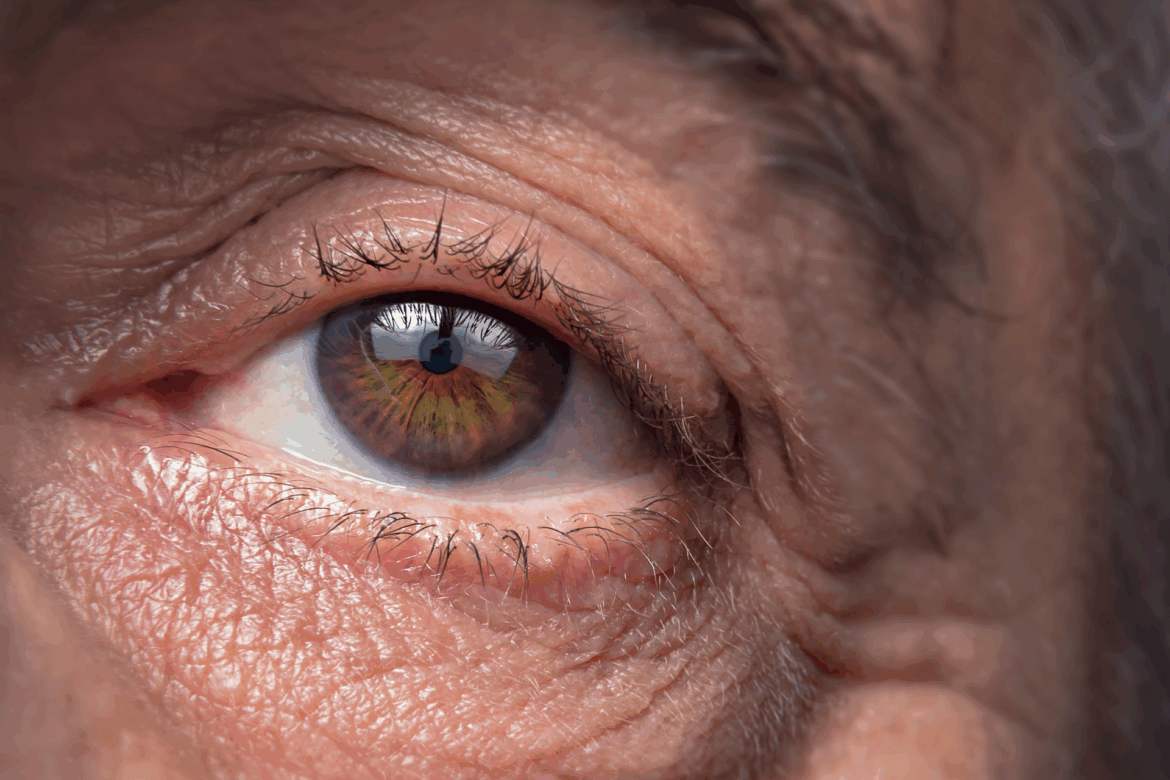 Alternative Treatment for Rod-Cone Dystrophy with Microacupuncture